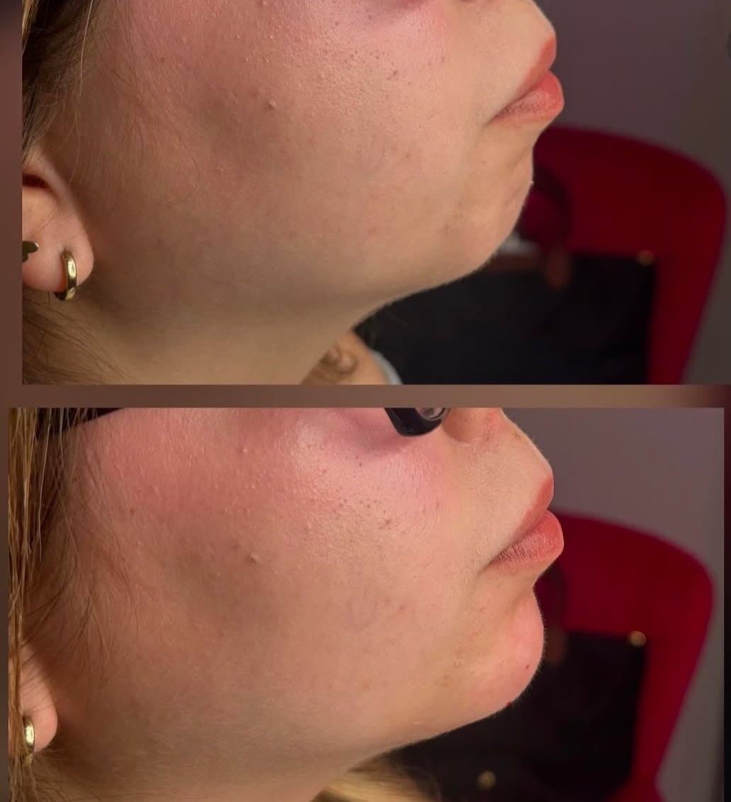 Refresh client result preview