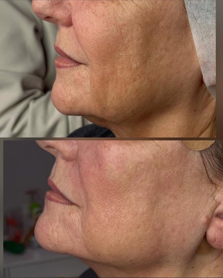 Refresh client result preview